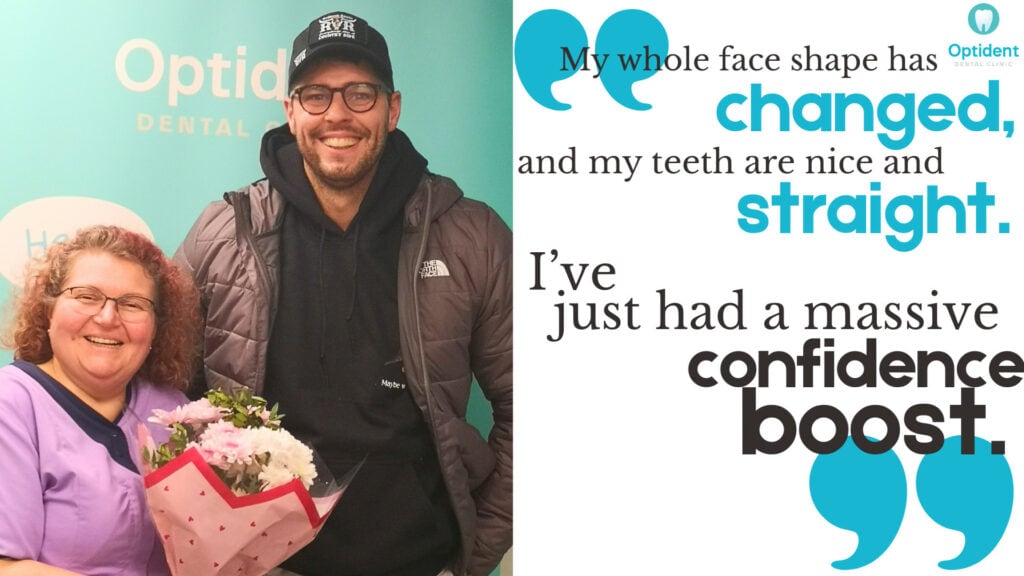Patient showing confi dent smile after orthodontic treatment with clear aligners in Essex